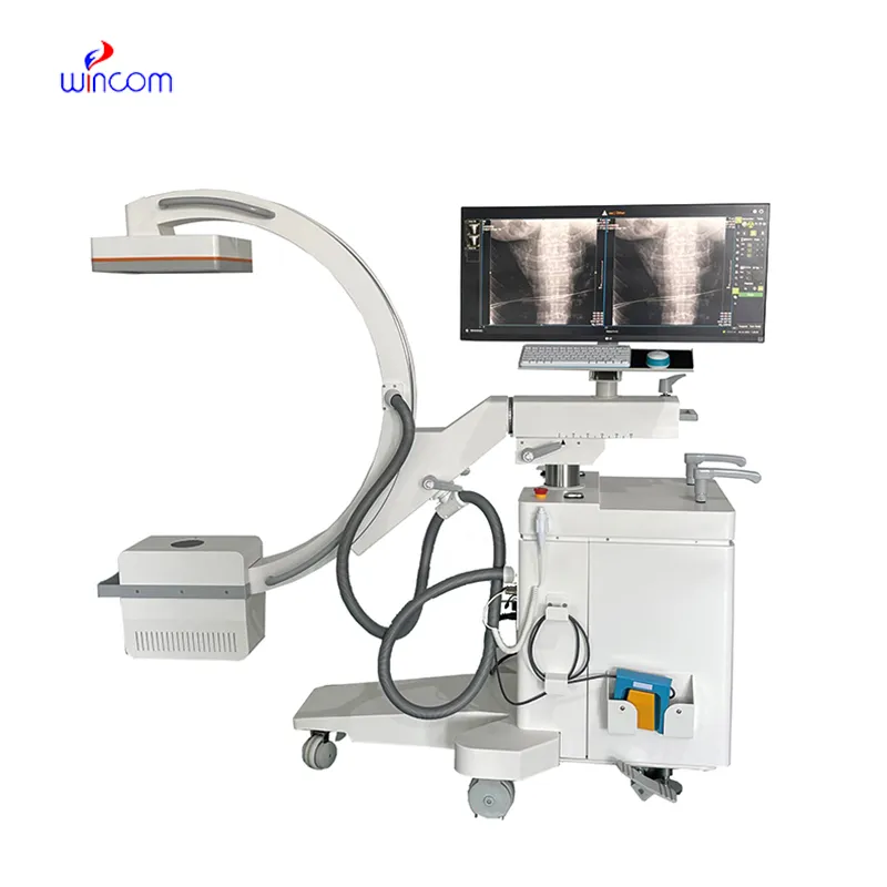 5kW 평판형 검출기 모바일 C-arm X-ray 장비 XRY-500C